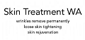 Skin Treatment WA